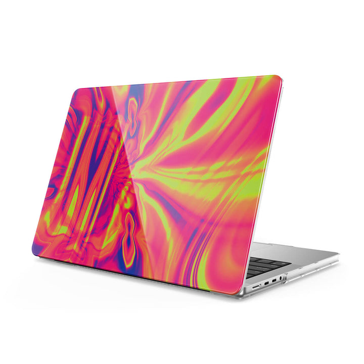 Contrôle - Coque MacBook