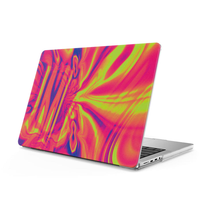 Control - Macbook Case