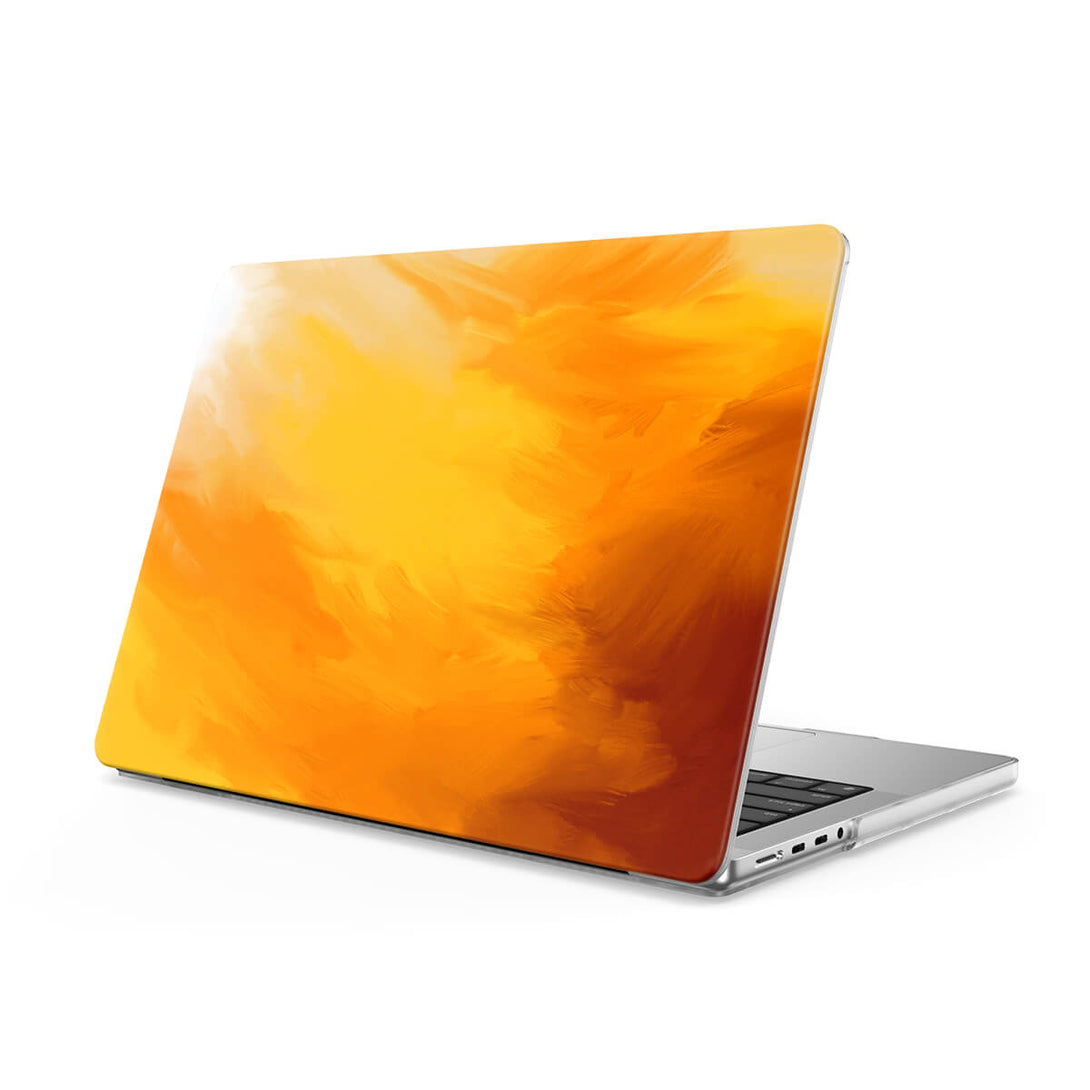 Autumn Story - Macbook Case