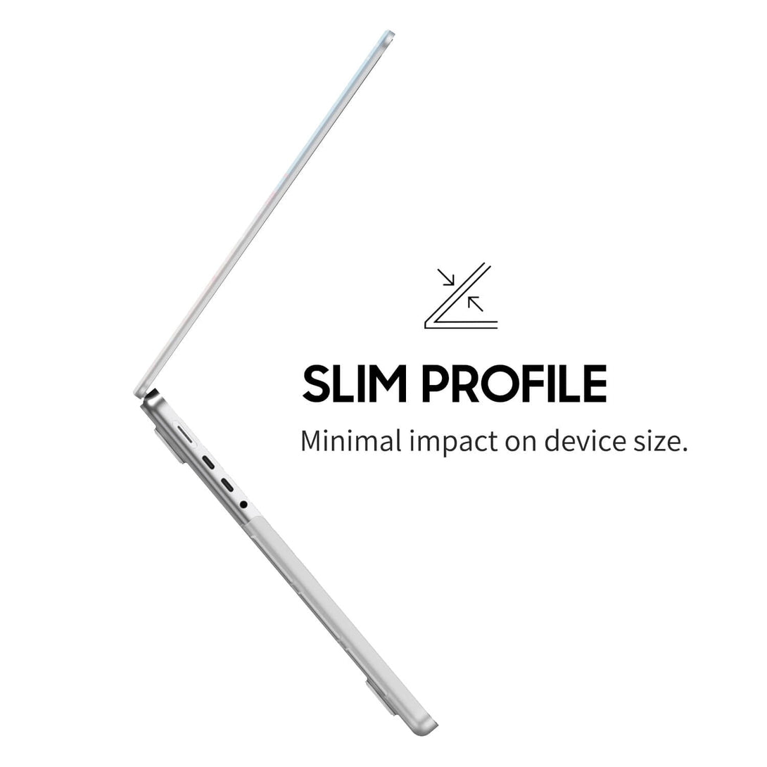 Sweet Strawberry - Macbook Case