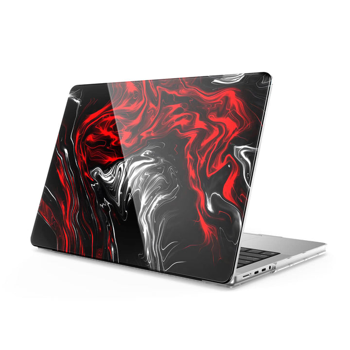 Resentment - Macbook Case