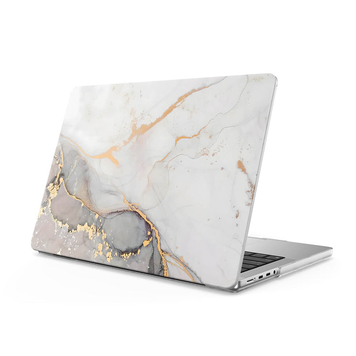 Gray Gold Sand - Macbook Case