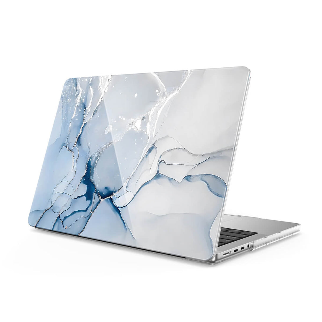 Jazz Silver - Macbook Case