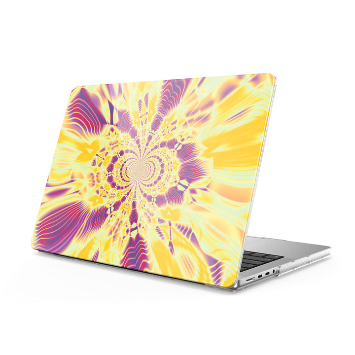 Queen - Macbook Case