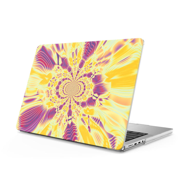 Queen - Macbook Case