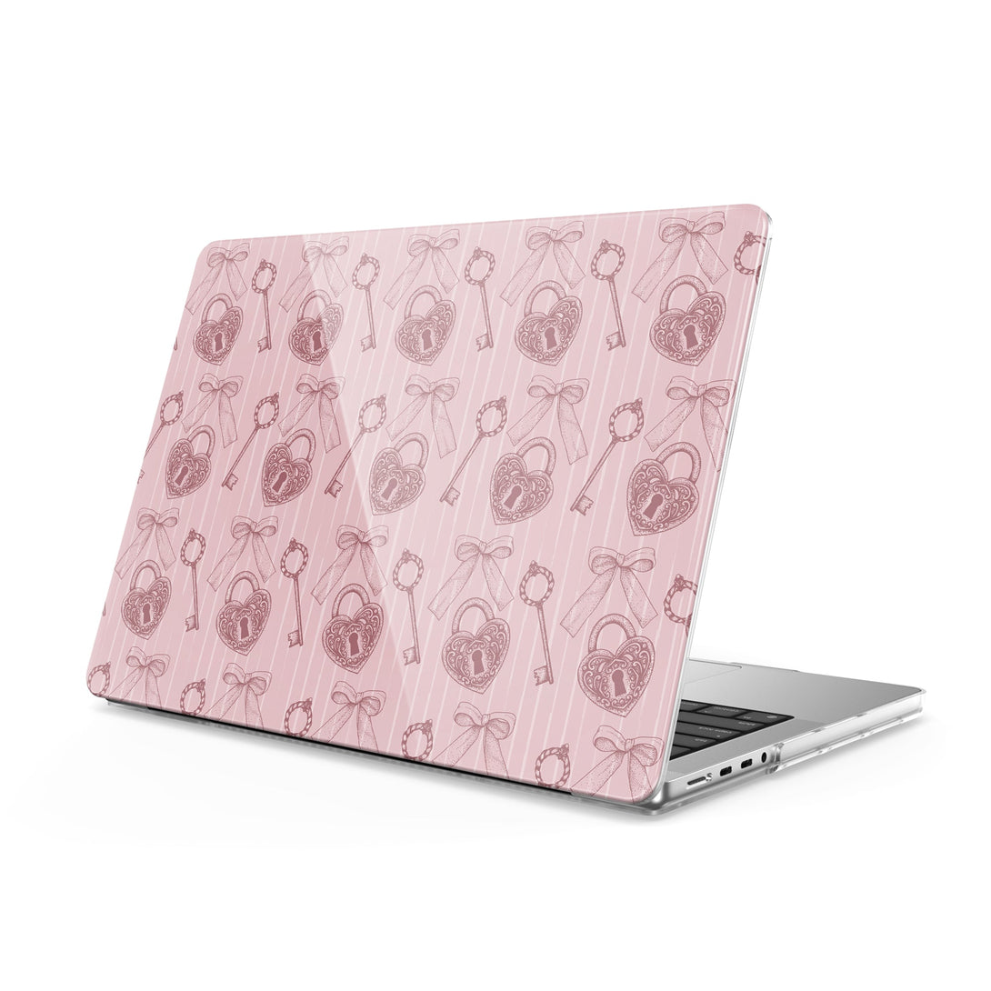 Untie - Macbook Case