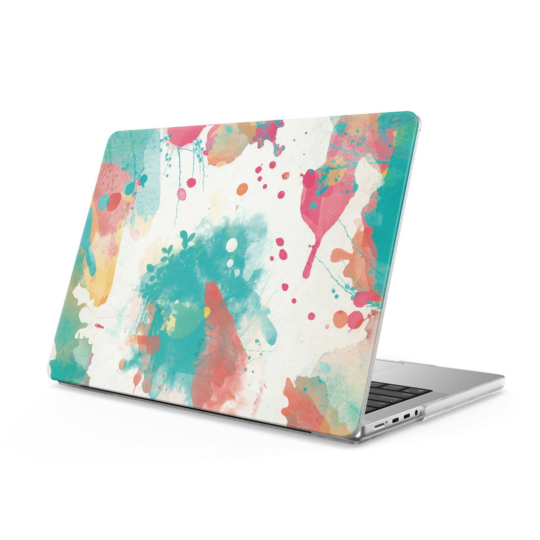 New Born - Macbook Case