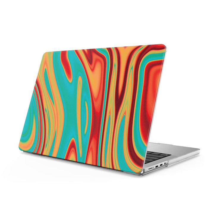 Performance - Macbook Case