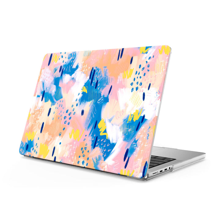 Shining Moment - Macbook Case