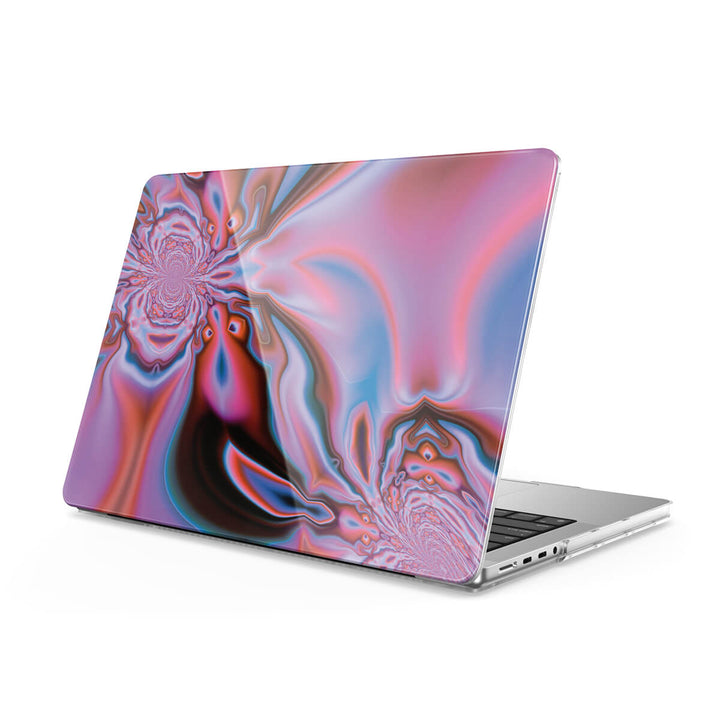 Esclavage - Coque MacBook